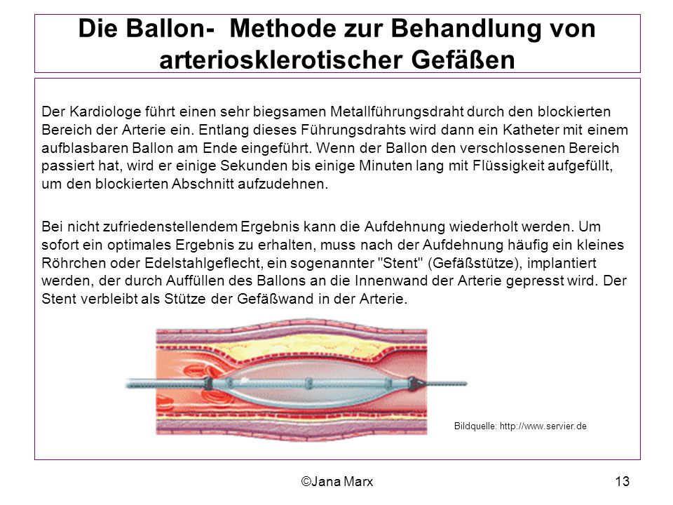 Der Alkoholismus die Nordvölker